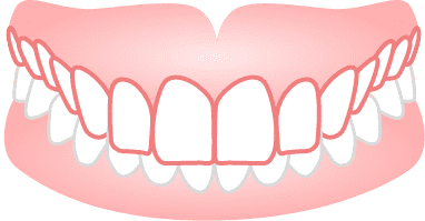 噛み合わせが深い(過蓋咬合)